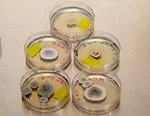 Different fungal species isolated from native and disturbed soils within Florida International University’s Miami campus and Everglades National Park. Photo credit Mary Tiedeman. 