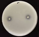 endophytes dissolving phosphorus