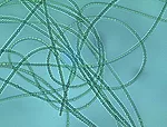 cyanobacteria