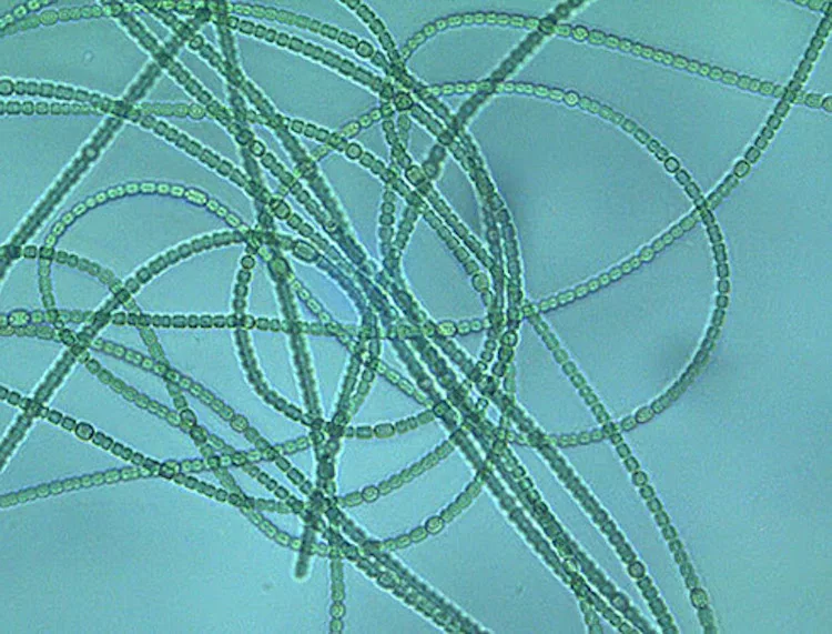 cyanobacteria