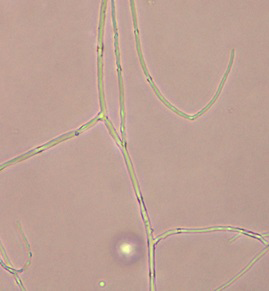 Mycelia of Rhizoctonia solani. This pathogen has mycelia that branch at 90 degree angles.